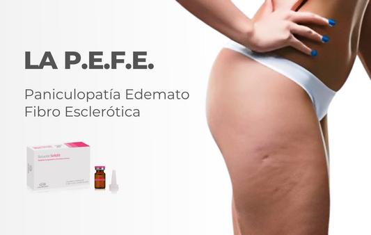 La P.E.F.E. (Celulitis) y su Manejo con Mesoterapia Transdermica